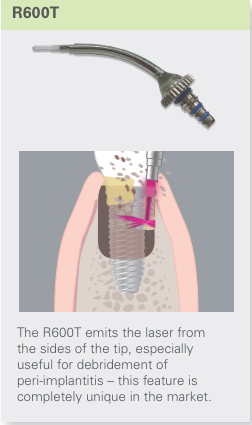 AdvErl Evo Tip R600T