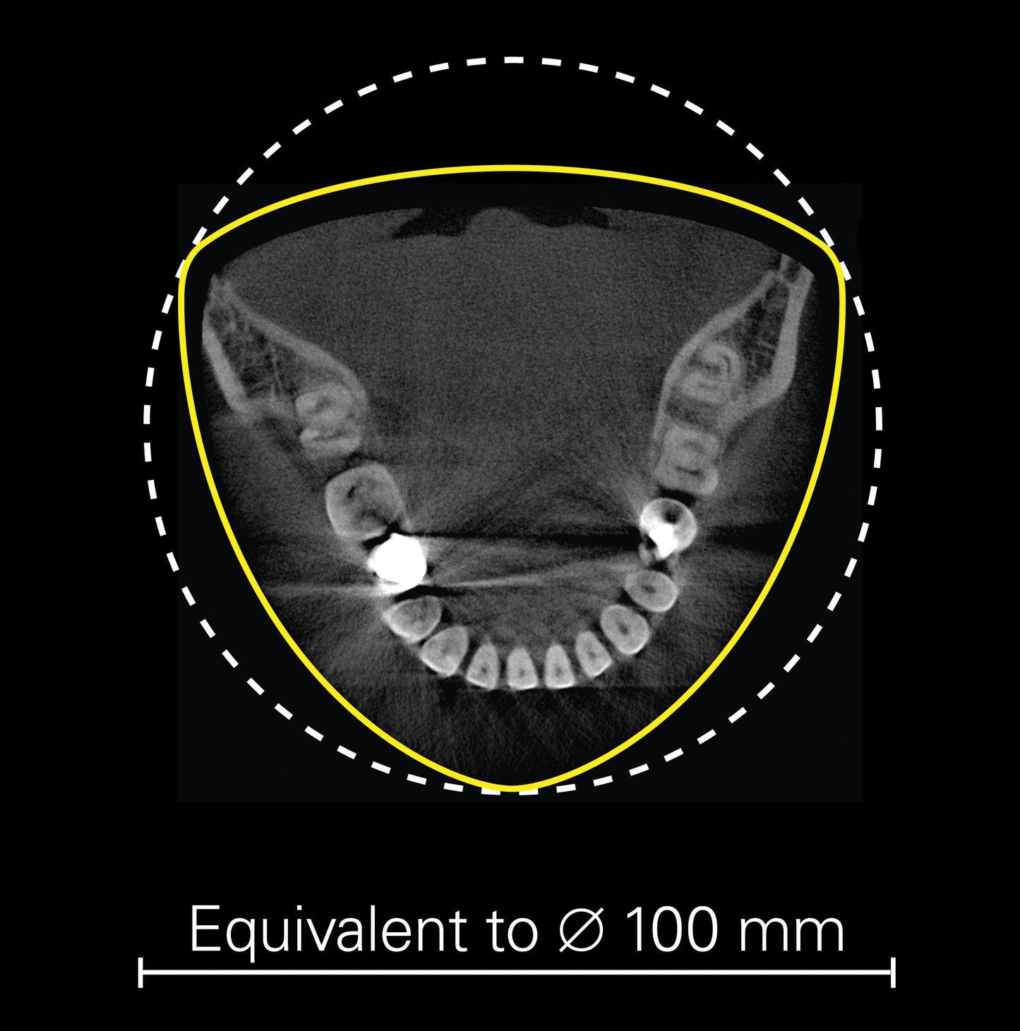 Veraviewepocs 3D R100
