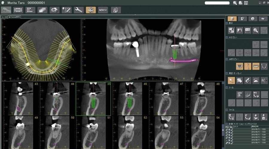 i-Dixel - 3D Imaging Software