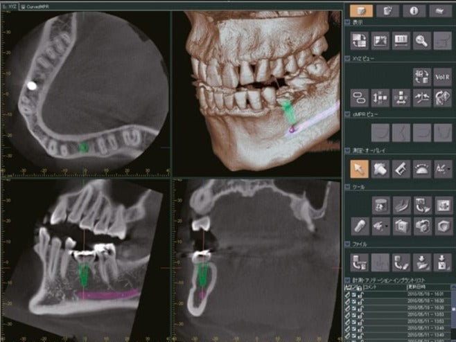 i-Dixel - 3D Imaging Software