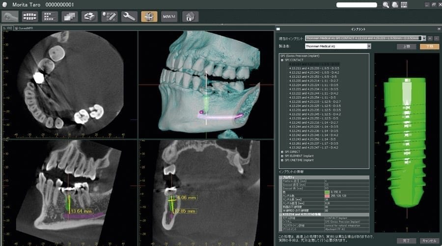 i-Dixel - 3D Imaging Software